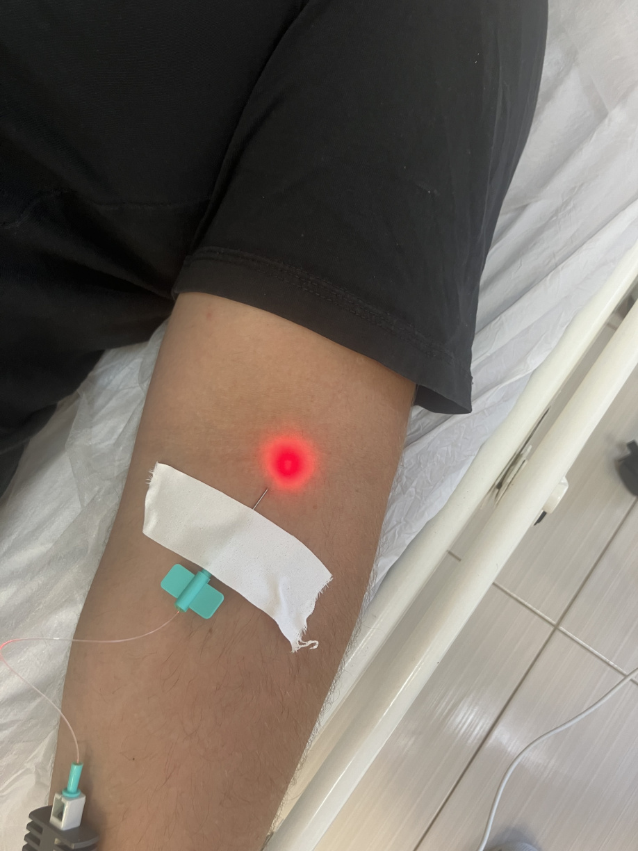 Процедура ВЛОК для лечения урологических болезней СПб Петроградская Карповка АндроМеда