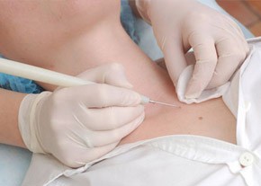  Удаление лазером родинки Петроградская Карповка СПб Клиника АндроМеда